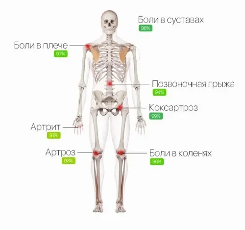 Hondrofrost : hol kapható vásárolni Magyarországon a gyógyszertárban?